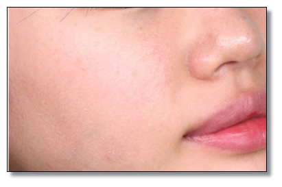 송파 피부과 추천