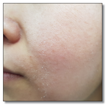 송파 피부과 추천