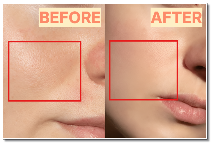 송파 피부과 추천